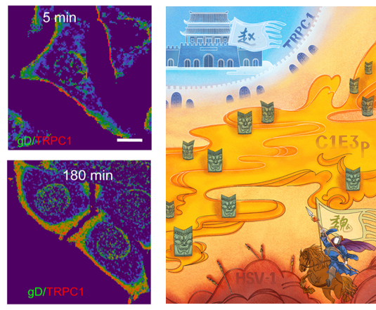 我校医学院马鑫教授团队在《ScienceAdvances》发表血管病变新机理的研究成果