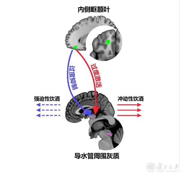 复旦大学类脑研究院团队合作提出酗酒行为成因新机制：强迫与冲动，同一个神经调控通路的正反面