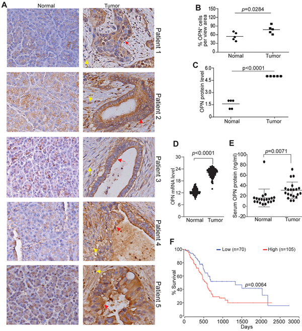 生命科学学院吕春婉团队JITC发文：胰腺癌免疫治疗取得新进展