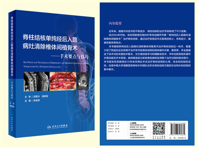 张宏其教授主编的《脊柱结核单纯经后入路病灶清除椎体间植骨术——手术要点与技巧》正式出版