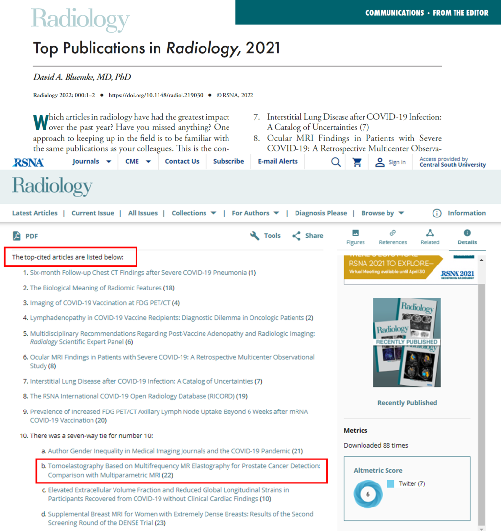 湘雅医院李文政教授团队论文入选Radiology期刊2021年度高被引论文（Top10）