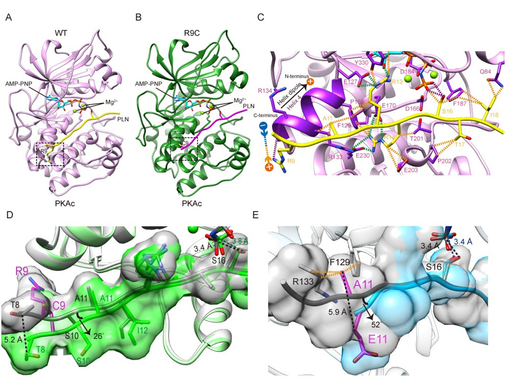 药学院尉迟之光团队揭示家族性扩张型心肌病发病机制