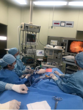 哈医大二院乳腺外科完成单孔腔镜非溶脂法NSM联合胸肌前假体+TiLoop补片Ⅰ期乳房重建术