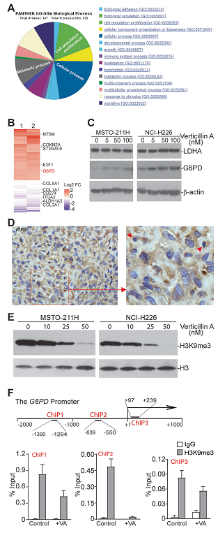 天津大学生命科学学院吕春婉团队Nature子刊发文：破解磷酸戊糖途径调控间质瘤死亡的机制
