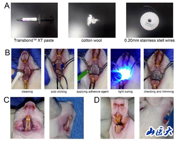 科技之光︱口腔医学院武秀萍团队发文阐释PTHrP及其受体PTH1R在咬合升高所致颞下颌关节炎发生发展过程中的致病机制